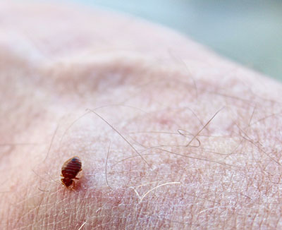 Bed bug on human skin